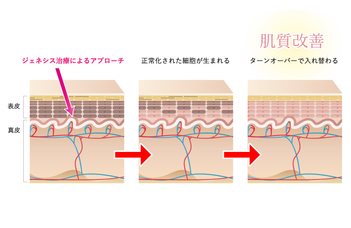 ジェネシス